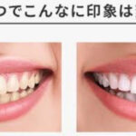 黄ばんでいる歯と白い歯の写真