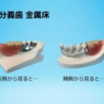 義歯の写真